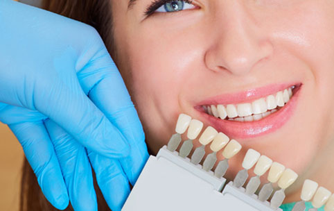 Doctor holding a teeth whitening color card next to a young woman's teeth