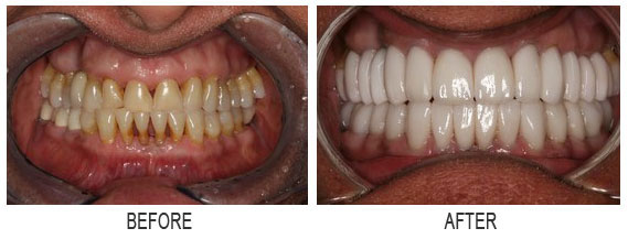 images before after 6 a